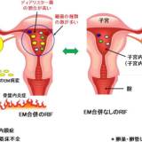 【研究】難治性不妊症の患者、歯周病菌を子宮内から高頻度に検出 山梨大など