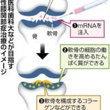 【膝の痛みにｍＲＮＡ注入で軟骨摩耗防ぐ】東京医科歯科大などのチームが治験へ、整形外科で実用化なら世界初・・・対象の病気は「変形性膝関節症」で、国内の患者は推計２０００万人以上に上る