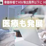 【エイズ（AIDS）の最前線を取材】南アフリカ 「若い女性が男性の3倍感染」 感染拡大の根底にある“年上男性からの感染”