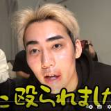 【YouTuber】高学歴YouTuber 登録者100万越えYouTuberに暴行を受け緊急搬送されたと告白「数字持ってから言えよって」