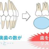 【大阪大研究】奥歯のかみ合わせの悪化、歯を失うリスクが最大6倍に　10万人調査