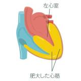 【心臓病のスペシャリスト】新型コロナウイルス感染後遺症に多い心筋炎・心膜炎に要注意！　心不全パンデミック